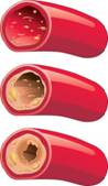 arteries
